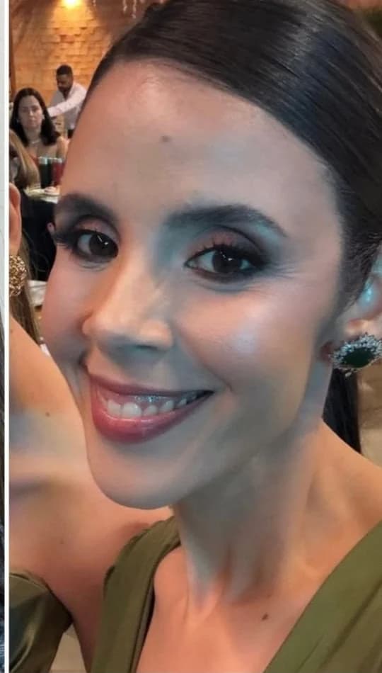 Depois do procedimento de Bioestimuladores de Colágeno